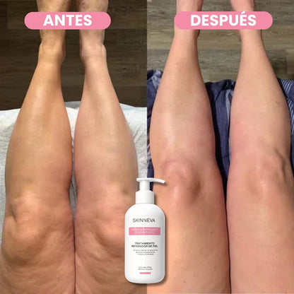 Tratamiento Reafirmante Anti Celulitis & Flacidez · XL - 250g.