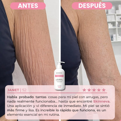 Tratamiento Reafirmante Anti Celulitis & Flacidez · XL - 250g.