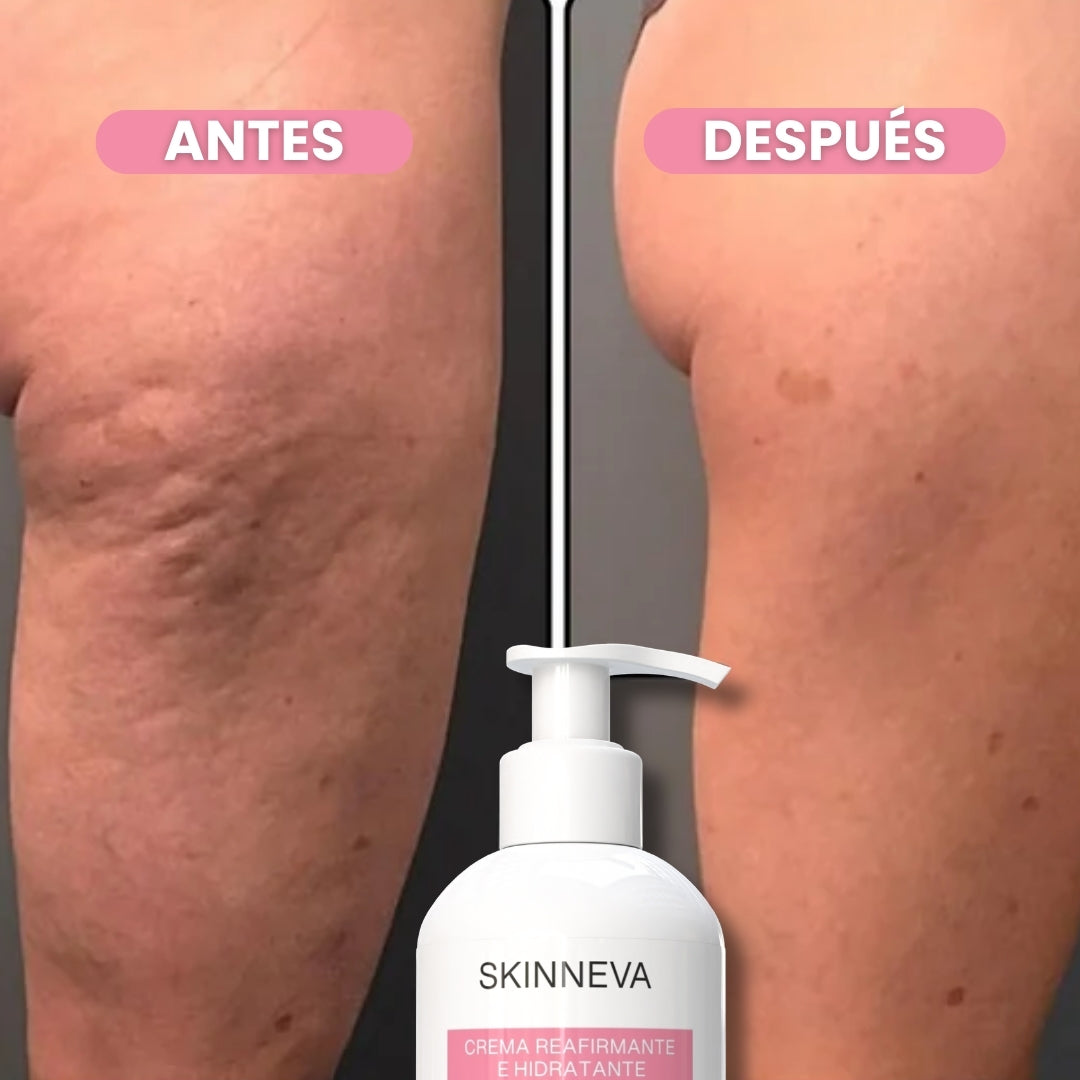 Tratamiento Reafirmante Anti Celulitis & Flacidez · XL - 250g.